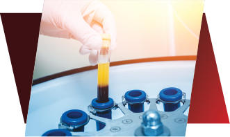 Step 2 – Separation, centrifugation and balance