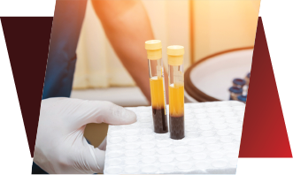 Step 3 – GLOW PRP collection